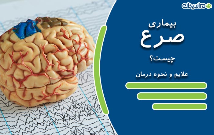 بیماری صرع چیست و چه علائمی دارد + علل و نحوه درمان